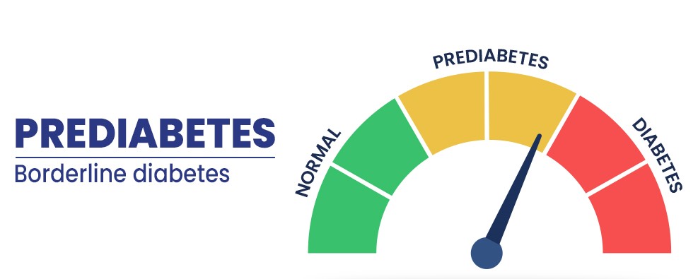 PREDIABETES 2 copy Post