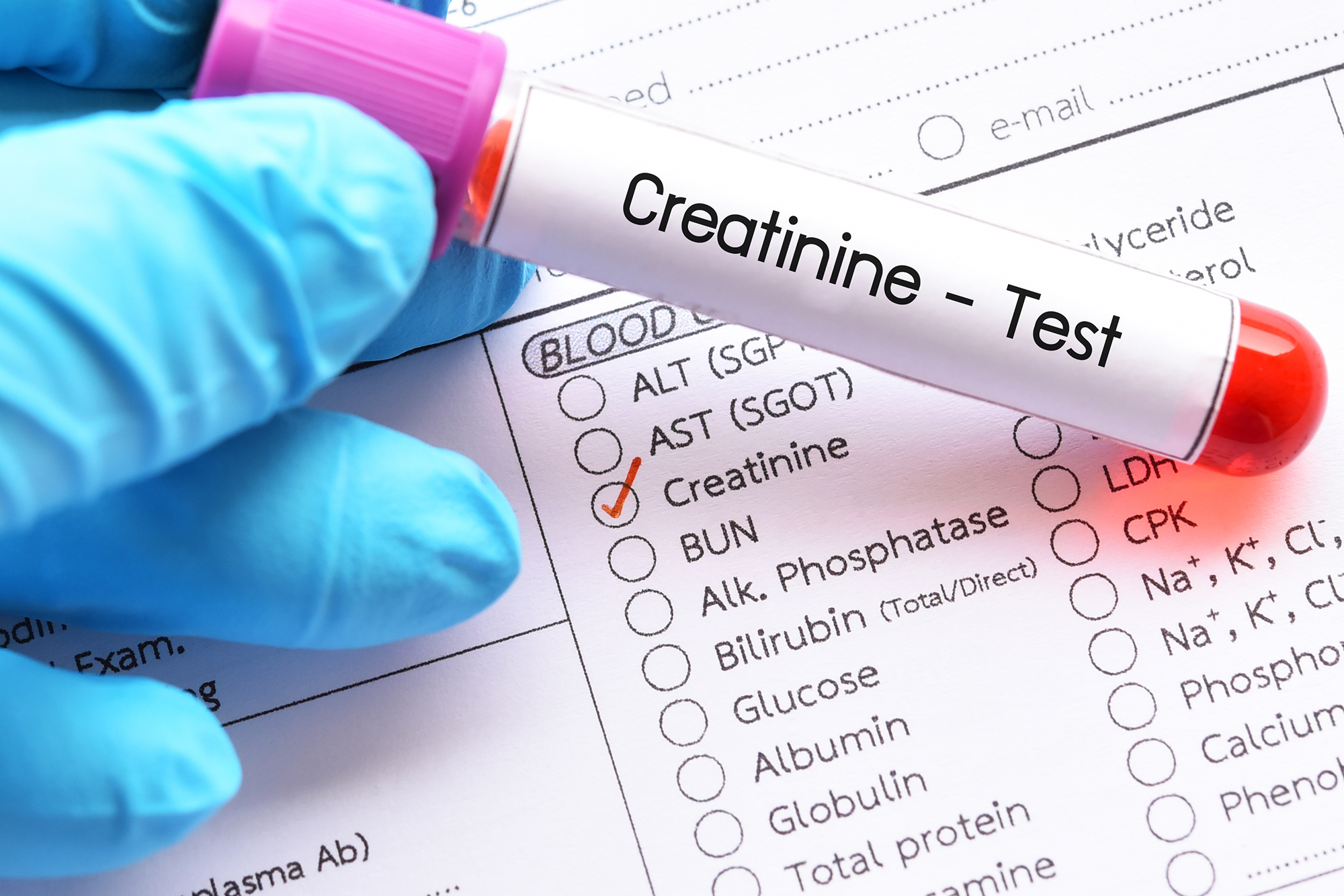 Creatinine Test High Low Normal Levels 1 Post