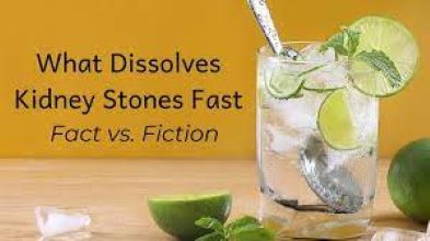 Can Your Kidney Stones Be Melted by Lemonade?