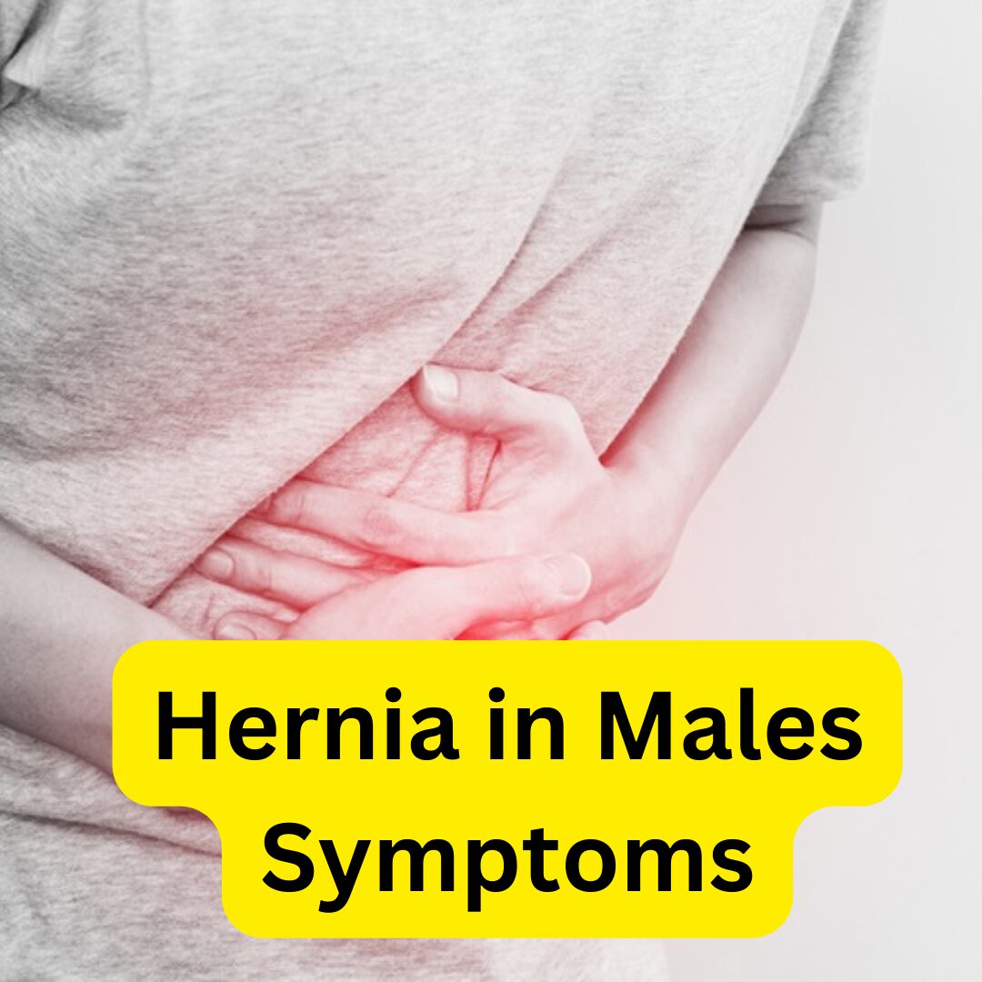 Hernia in Males Symptoms